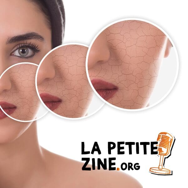 Comment prendre soin d'une peau sèche ? 9