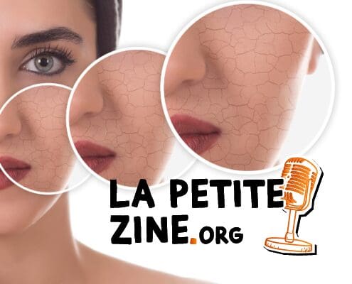 Comment prendre soin d'une peau sèche ? 9