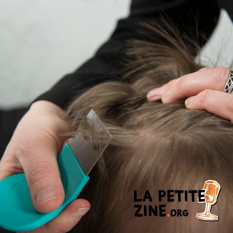 Poux et lentes : comment les éliminer naturellement ?